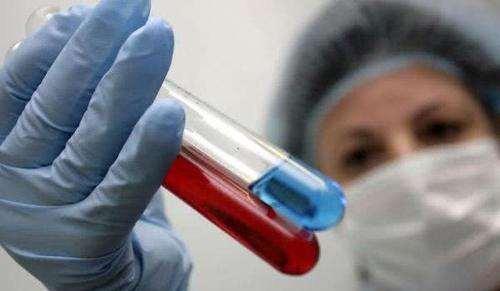 尿酸高注意饮食自己能降下来吗,尿酸高平时注意饮食可以降下来吗