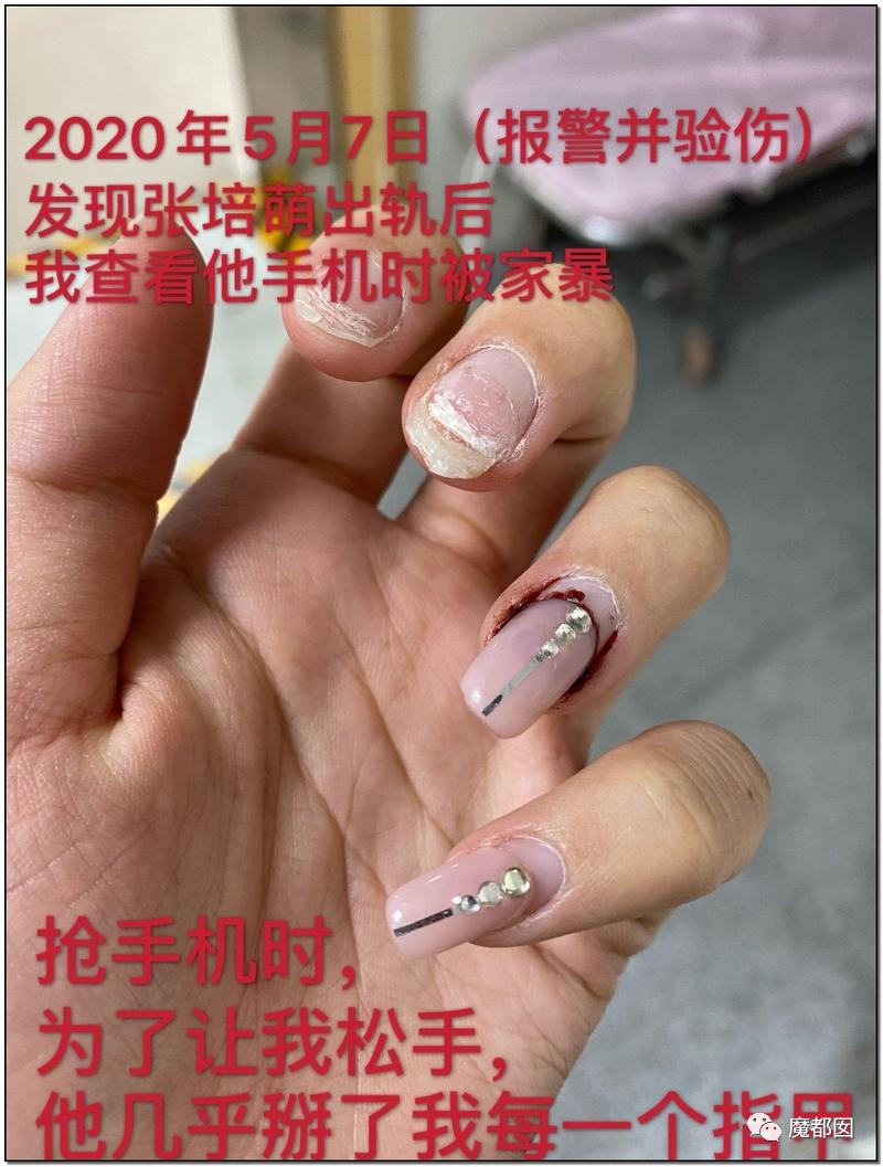 短跑名将张培萌家暴事件,短跑名将张培萌殴打岳母视频