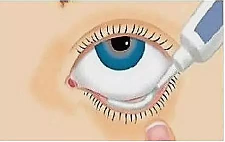 成人眼药水儿童能使用吗,儿童眼药水的正确使用方法