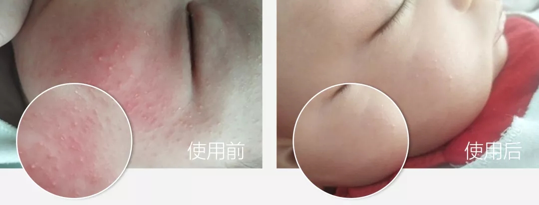 日本敏感皮肤面霜,日本人五合一面霜