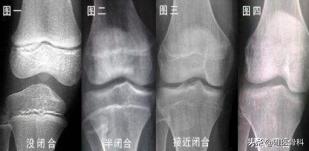 跳高的理想身高,跳高之星