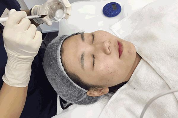 祛痘印小方法和步骤有哪些,痘印肌肤的护肤方法