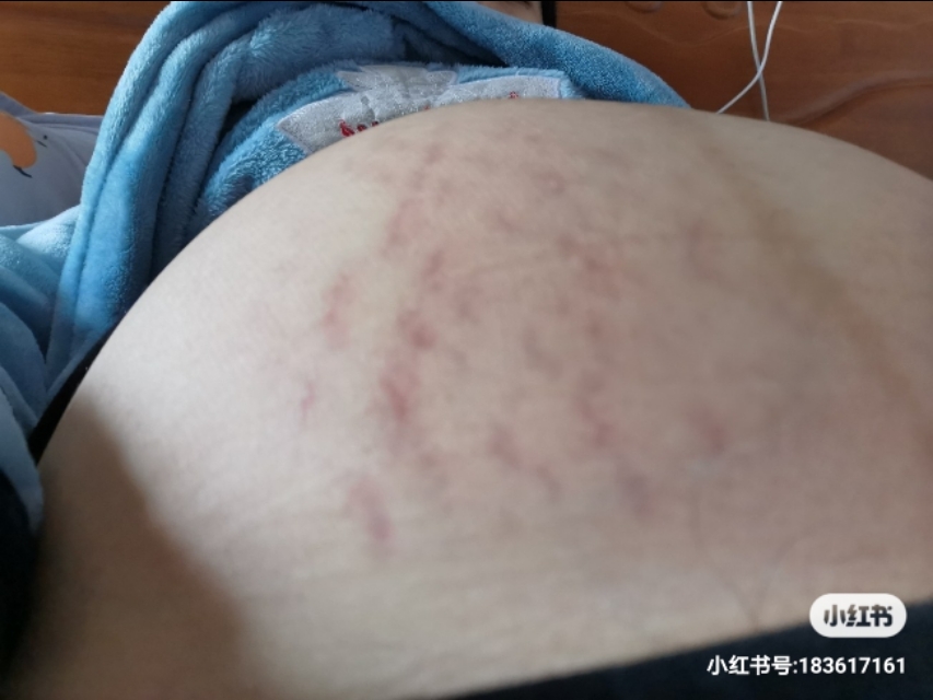 大家怀孕的状态,大家怀孕的日子怎么过