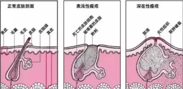 最强蜂胶,超级天然蜂胶