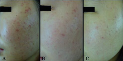 <html>
<head><title>502BadGateway</title></head>
<body>
<center><h1>502BadGateway</h1></center>
<hr><center>nginx</center>
</body>
</html>
<!--apaddingtodisableMSIEandChromefriendlyerrorpage-->
<!--apaddingtodisableMSIEandChromefriendlyerrorpage-->
<!--apaddingtodisableMSIEandChromefriendlyerrorpage-->
<!--apaddingtodisableMSIEandChromefriendlyerrorpage-->
<!--apaddingtodisableMSIEandChromefriendlyerrorpage-->
<!--apaddingtodisableMSIEandChromefriendlyerrorpage-->
