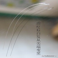 为什么会有黄痰排出,为什么会有黄痰呢