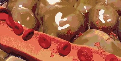 经常手麻脚麻是什么原因和征兆,解决经常手麻脚麻的最好方法