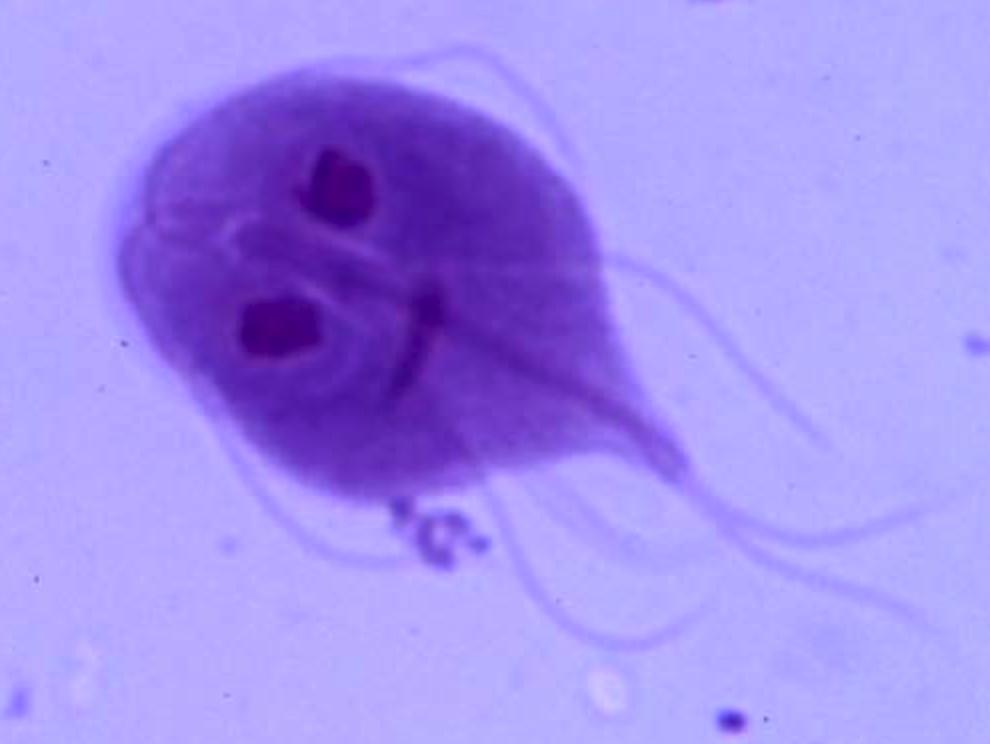 可以通过动物传染的疾病,哪些由动物传染给人类的致命疾病