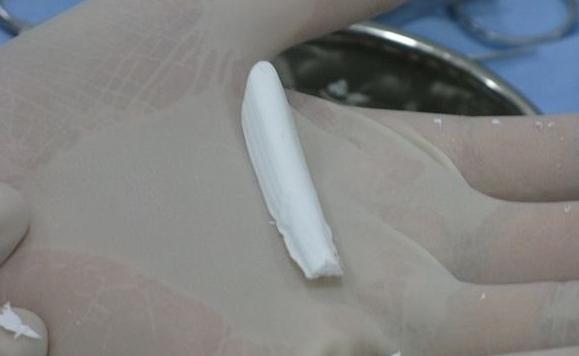 隆鼻方法,隆鼻比较好的方法