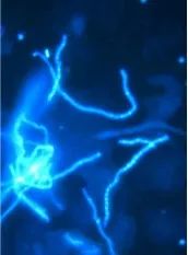 十大皮肤病的偏方,听信偏方的患者