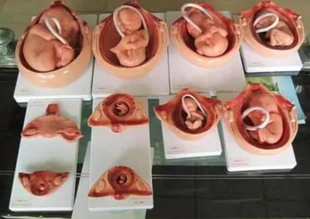 人工流产后的胎儿去哪了,医院人工流产的胎儿是怎样处理的