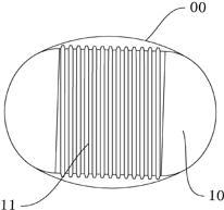 被胃镜支配的恐惧你知道吗：新型无痛胃镜胶囊，胃病患者的福音