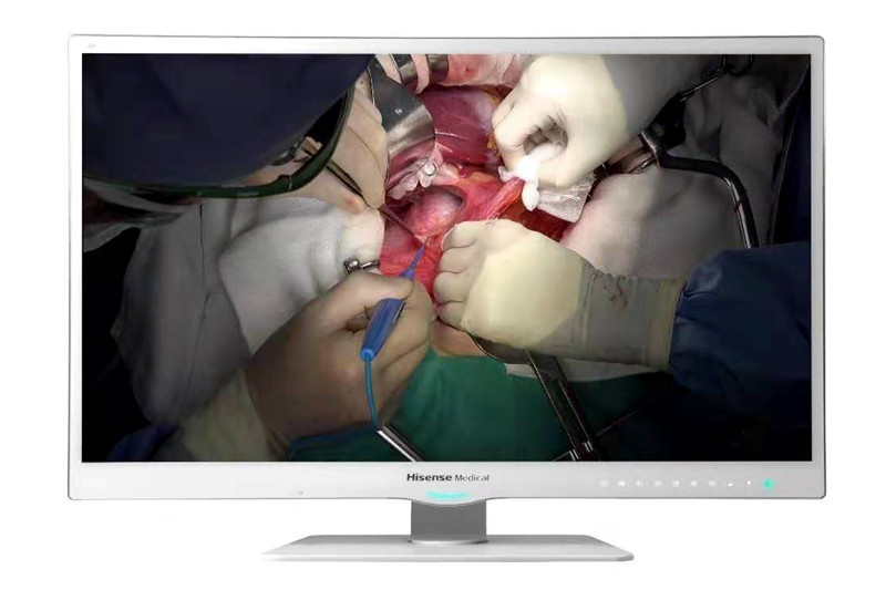 海信医疗推出4K超高清内窥镜显示器，预计8月上市