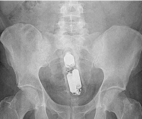 不作死就不会死看看你中了几条,不作死就不会死让人看的头皮发麻