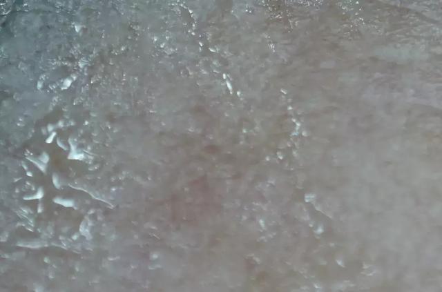 硬刚女皇龙妈也扛不住法令纹,2条沟壑让人心疼,贴一贴就消了