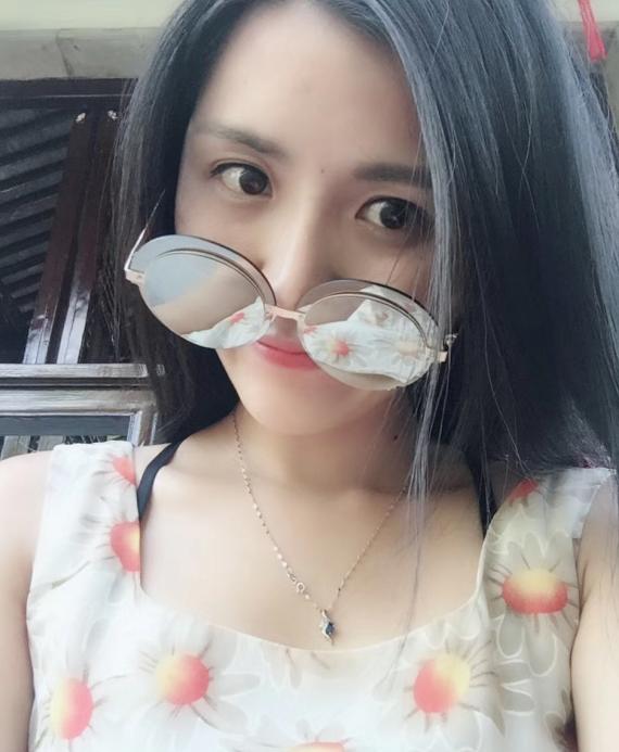 青褐斑激光治疗后颜色会加深吗,激光可以淡化褐斑吗