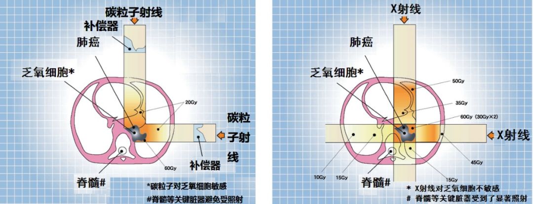 尊享e生2022普惠版,尊享e生和百万医疗区别