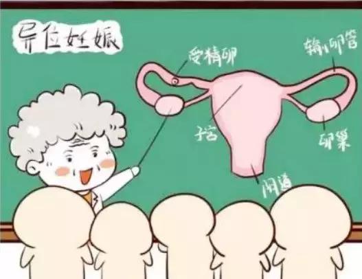 孕妇出血多少就判定流产了,孕期出血流产的几率有多大