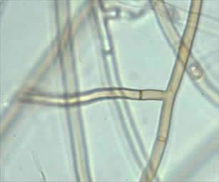 草莓芽尖枯了是不是烧苗了,草莓芽枯病用什么药