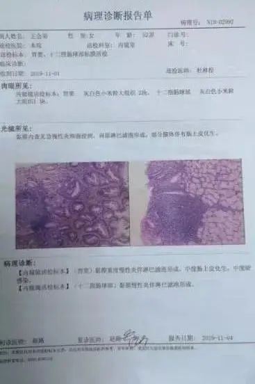 如何看懂胃镜活检报告,胃镜病理活检报告一般需几天