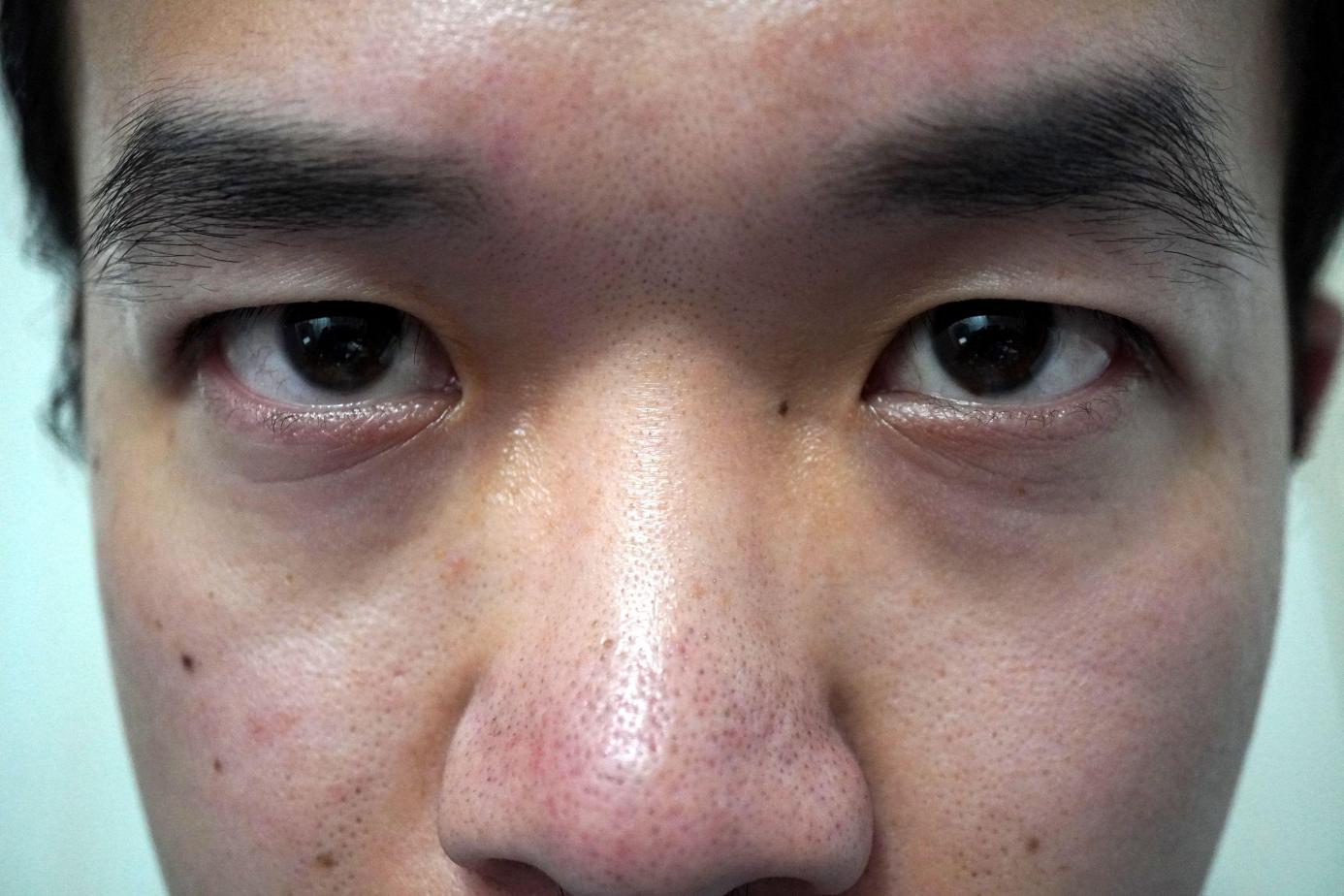 油性皮肤如何补水控油,油性肌肤控油小技巧