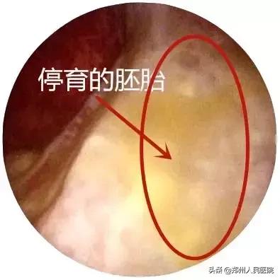 这个小镜子,照看着世上最贵的“房子”