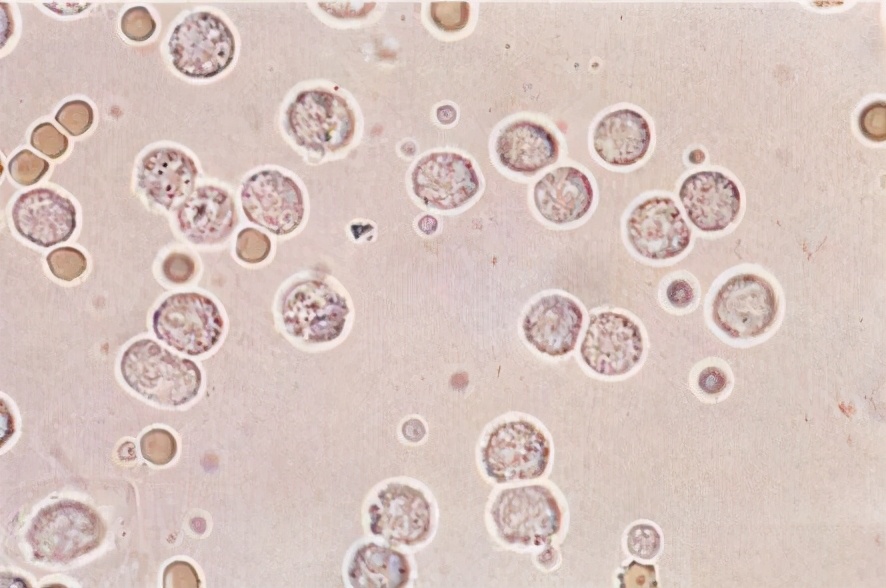 吃什么能治白细胞低,白细胞低吃什么药可以增加白细胞