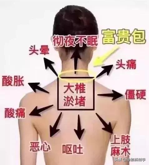 拉伸经络瑜伽视频30分钟,经络拉伸瑜伽60分