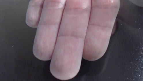 手指变皱像被水泡过,一只手容易泡皱什么原因