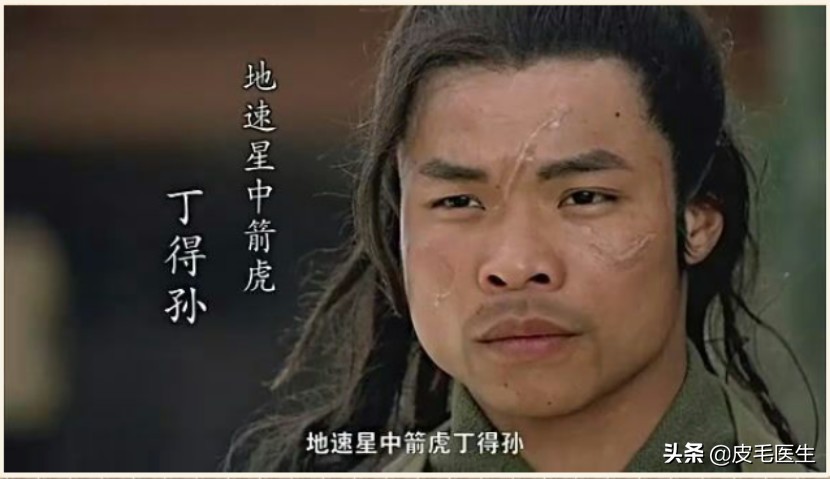 忍不住想给梁山好汉，送一台激光治疗仪