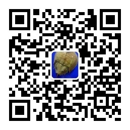 2.5万台电水壶或存锐利边缘，苏泊尔为啥问题频发？