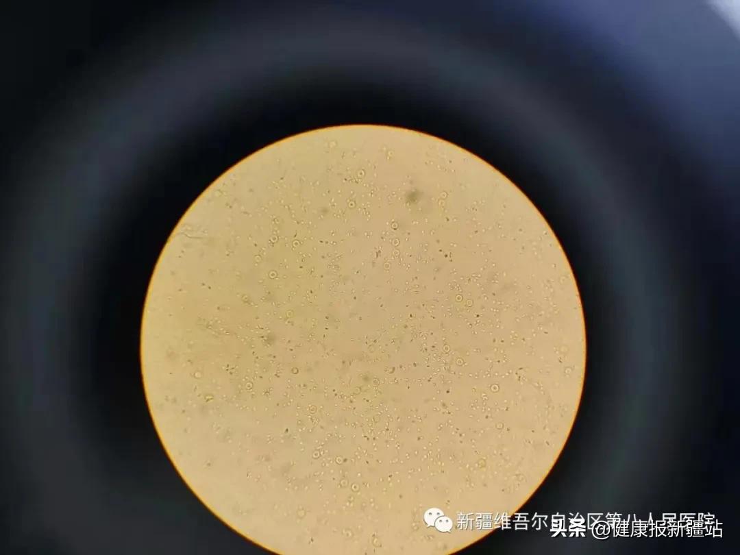 生殖科医生无精症,哪家医院专治男性无精症的