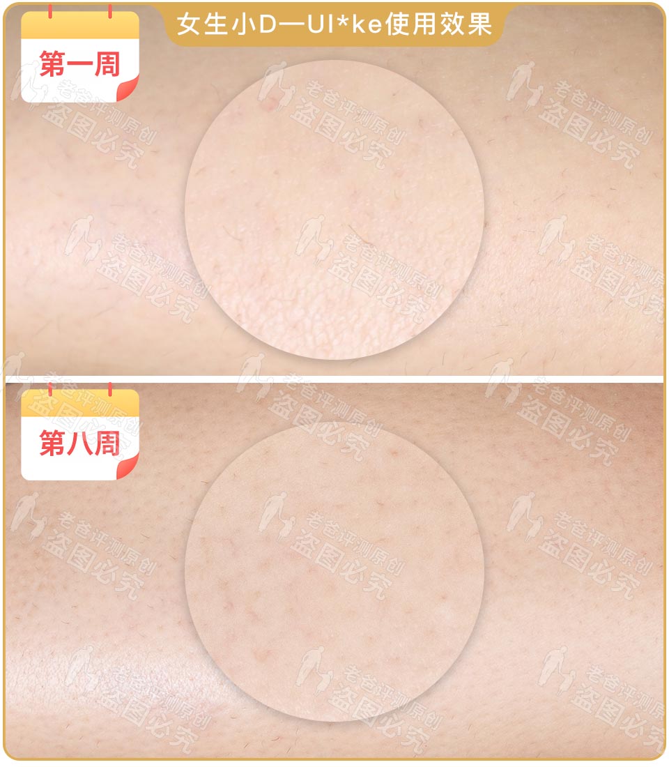 最真实的脱毛仪,bequeen脱毛仪实测