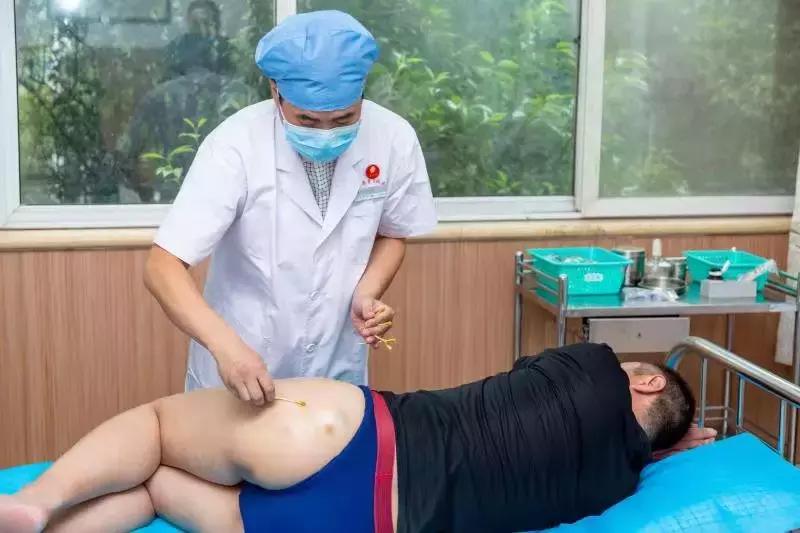 五虎擒羊是指什么穴位,五虎擒羊针法