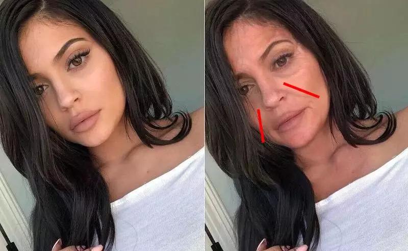 一招帮你搞定淡化法令纹,教你一招二天消除法令纹