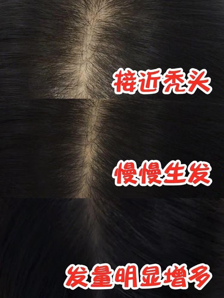 沙宣洗发水蓬松控油去屑,沙宣洗发水去油去屑推荐