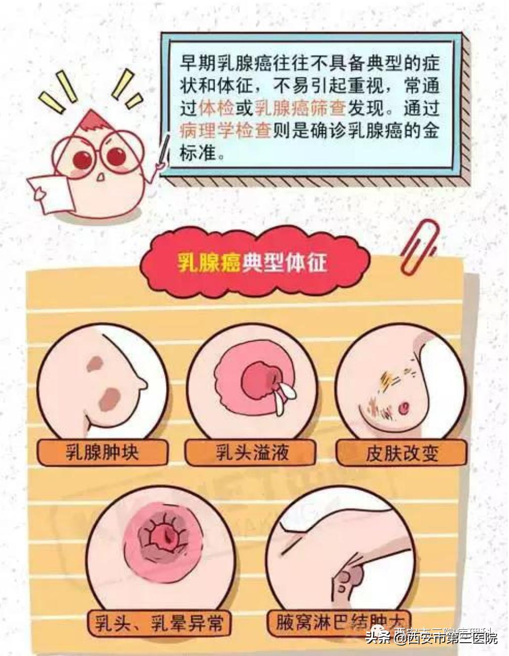 乳腺癌治疗史的不断演进,中医讲乳腺癌的真实故事