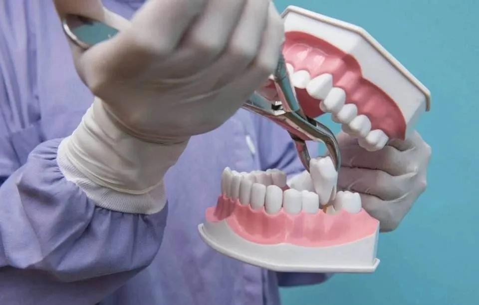 拔牙后干槽症清理过了但是还疼,拔牙三天了可以排除干槽症吗