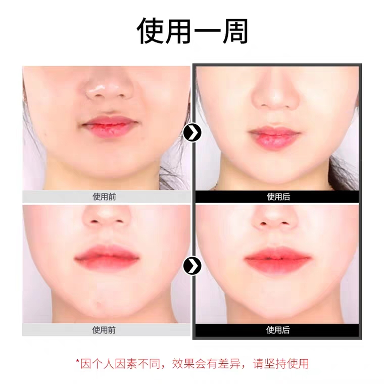 v脸面膜晚上贴还是起床贴,v脸面膜黑色