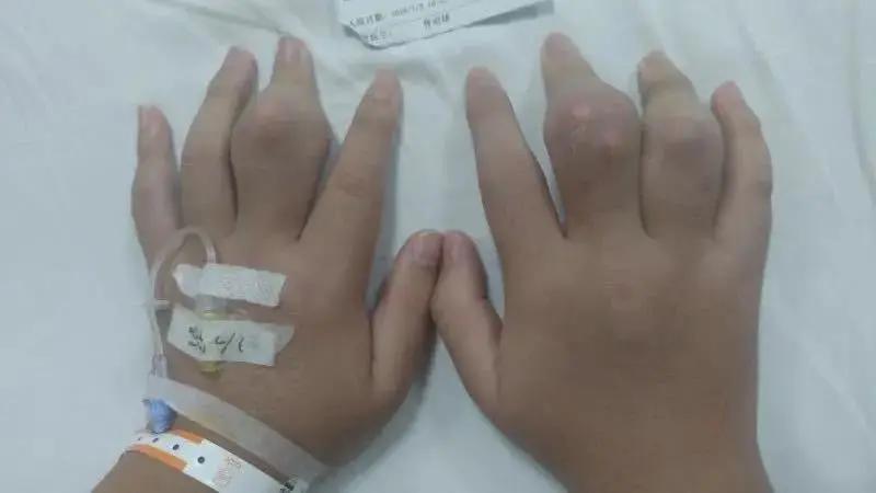 奶茶禁忌你知道吗,广东奶茶喝出问题