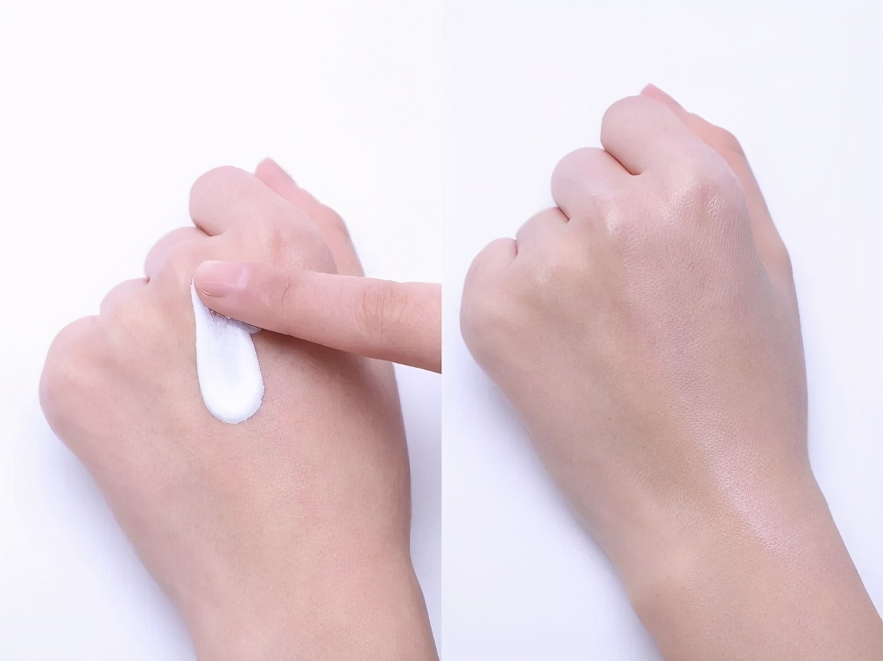 痘印表面好了里面没好,痘印发黑一直下不去用什么好