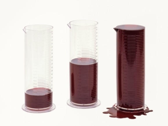 贫血有什么解决办法缺铁性贫血,缺铁性贫血怎么正确补血