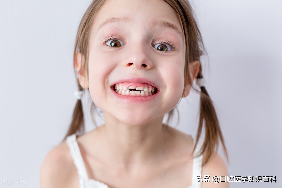 儿童牙齿乳牙有一点根没掉怎么办,孩子牙齿不掉也不换是缺钙吗