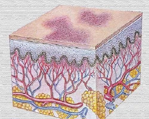 红血丝的四个雷区,关于红血丝你必须知道的几件事