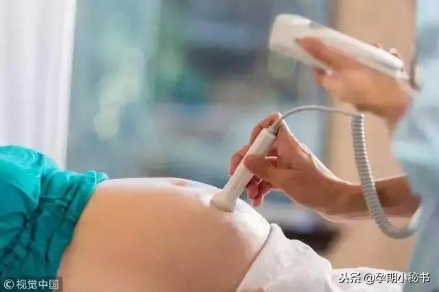 孕期产检必做的几大项,孕期第几周检查大排畸