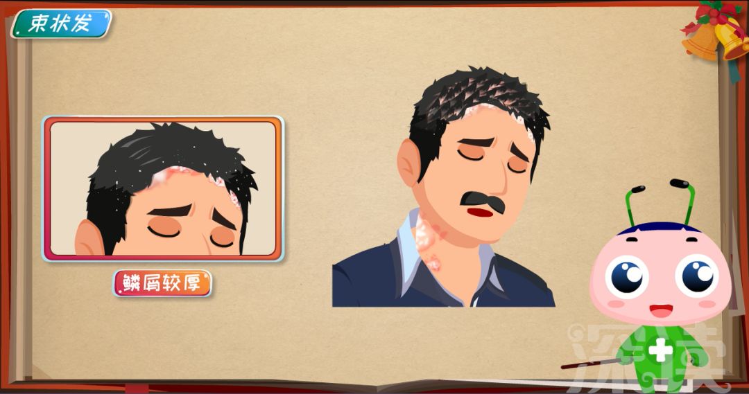 皮肤小红斑,皮肤小红点问题大全解答