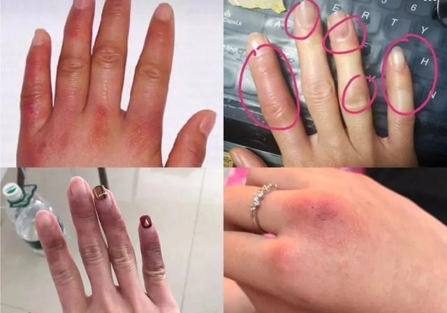 王凯手被投保3600万?林更新堵车时不忘涂手霜,我承认自己不精致