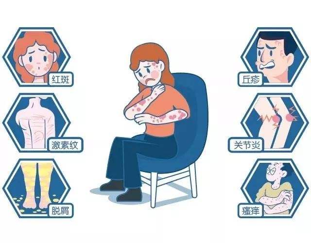 银屑病被称为不死癌症,银屑病真的不死吗