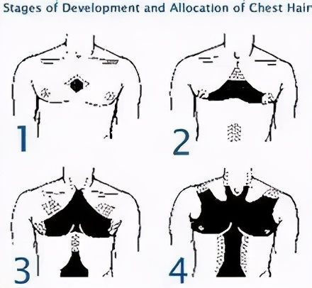 乳晕发黑变大怎么回事哺乳期,乳晕发黑变大怎么回事非哺乳期