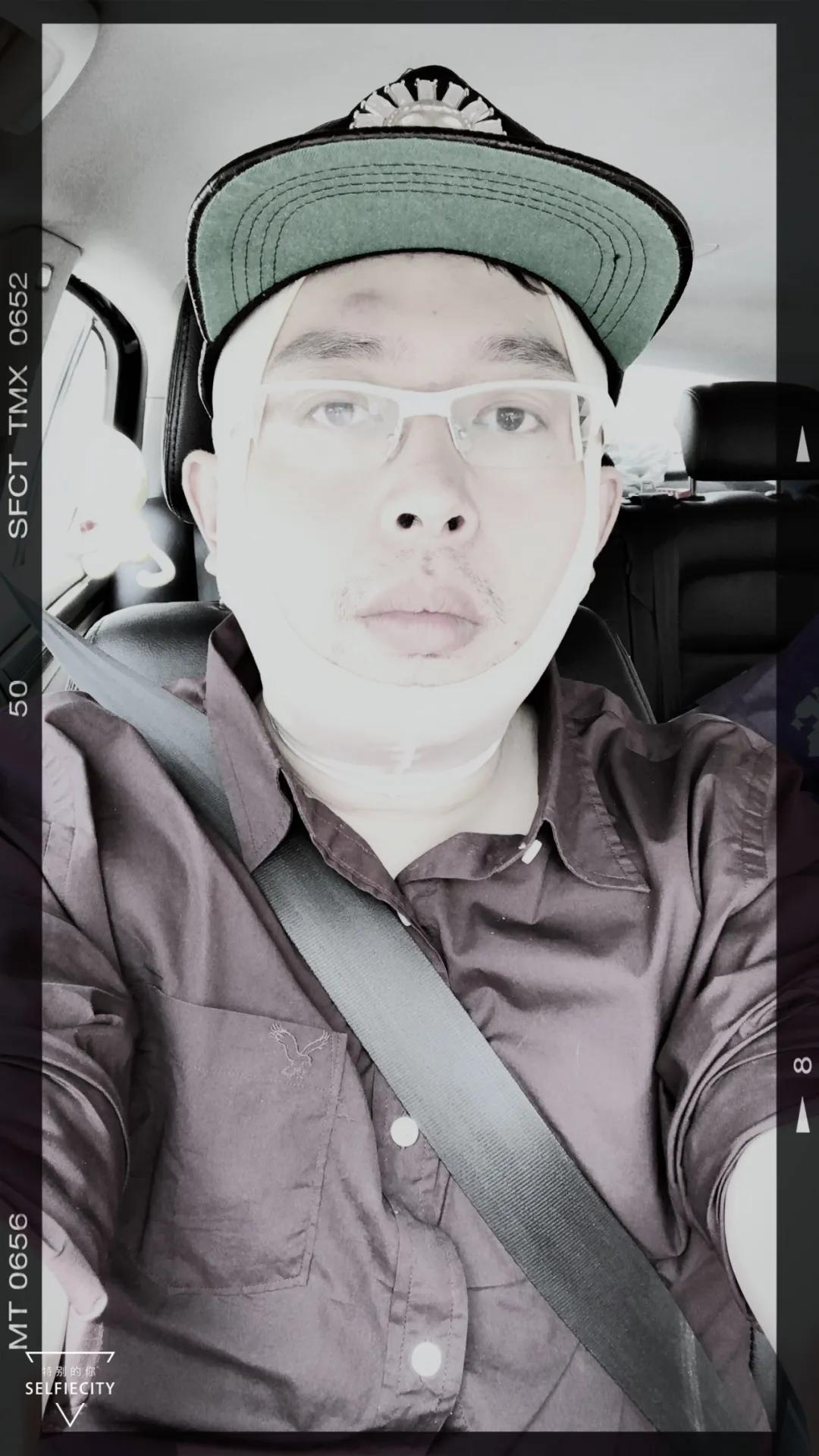 抽脂亲身经历回忆,抽脂血泪史